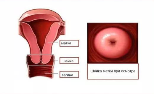 лейкоциты в щейке матки