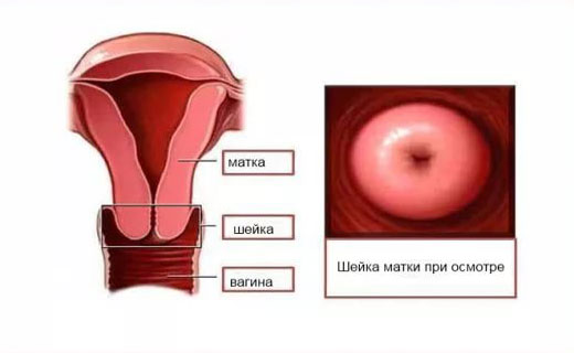 Как выглядит матка в жизни