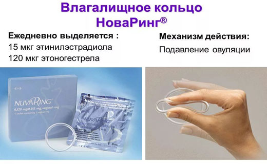 Ациклические кровотечения при новаринге thumbnail