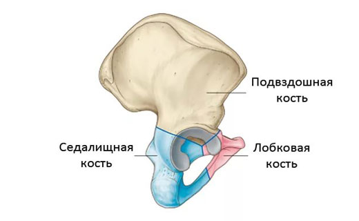 перелом седалищной кости