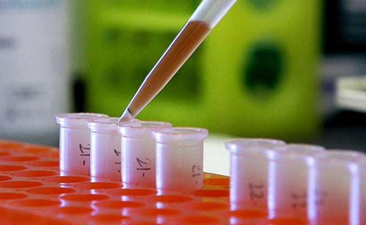 анализ крови объем тромбоцитов