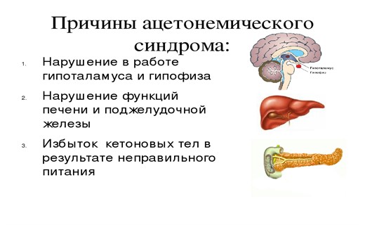 Ацетонемический синдром у детей - лечение и симптомы