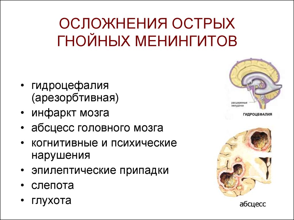 Острое гнойное осложнение