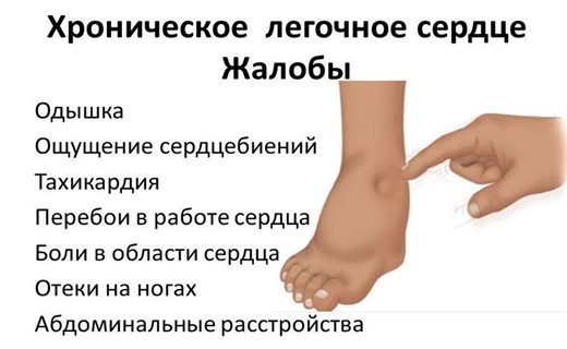 Как выглядит отек ног при сердечной недостаточности