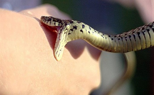 Фото укуса змеи