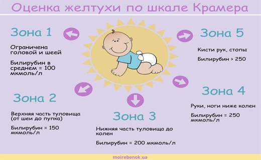Желтушка новорожденных сколько дней
